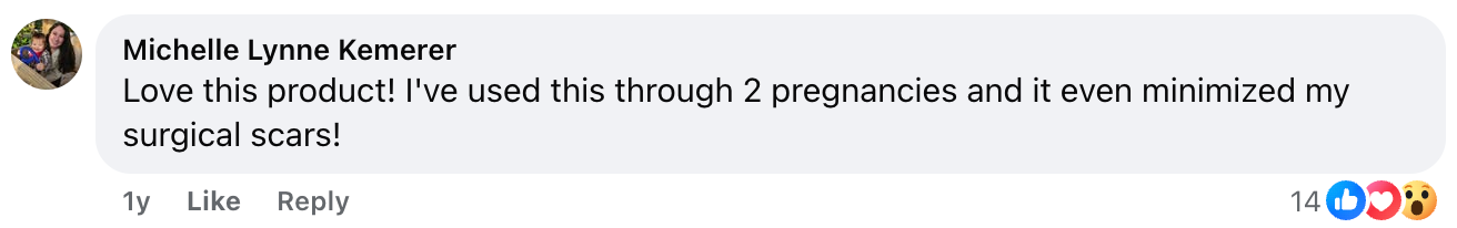 A Facebook comment from Michelle Lynne Kemerer says, Love this product! Ive used this through 2 pregnancies and it even minimized my surgical scars! The comment has 14 likes and 3 reaction emojis.