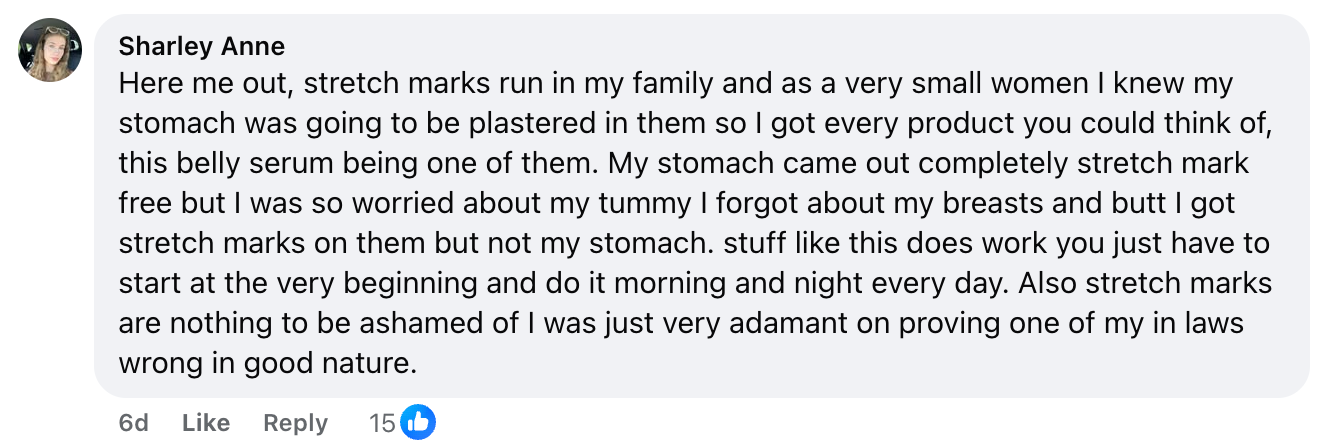 A Facebook comment by Sharley Anne discussing her experience with stretch marks, mentioning her use of belly serum, results, and advice about self-acceptance and dealing with in-laws opinions.