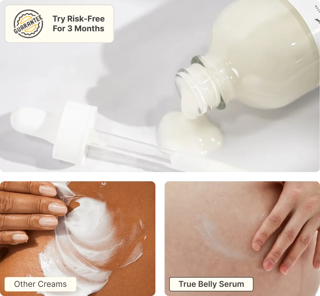 A bottle of white serum with a dropper is shown above two comparison images: one with cream being spread on skin labeled Other Creams, and another with serum applied to skin labeled True Belly Serum.