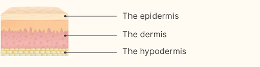Cross-section diagram of skin showing three labeled layers: the epidermis (top), the dermis (middle), and the hypodermis (bottom) in different colors.